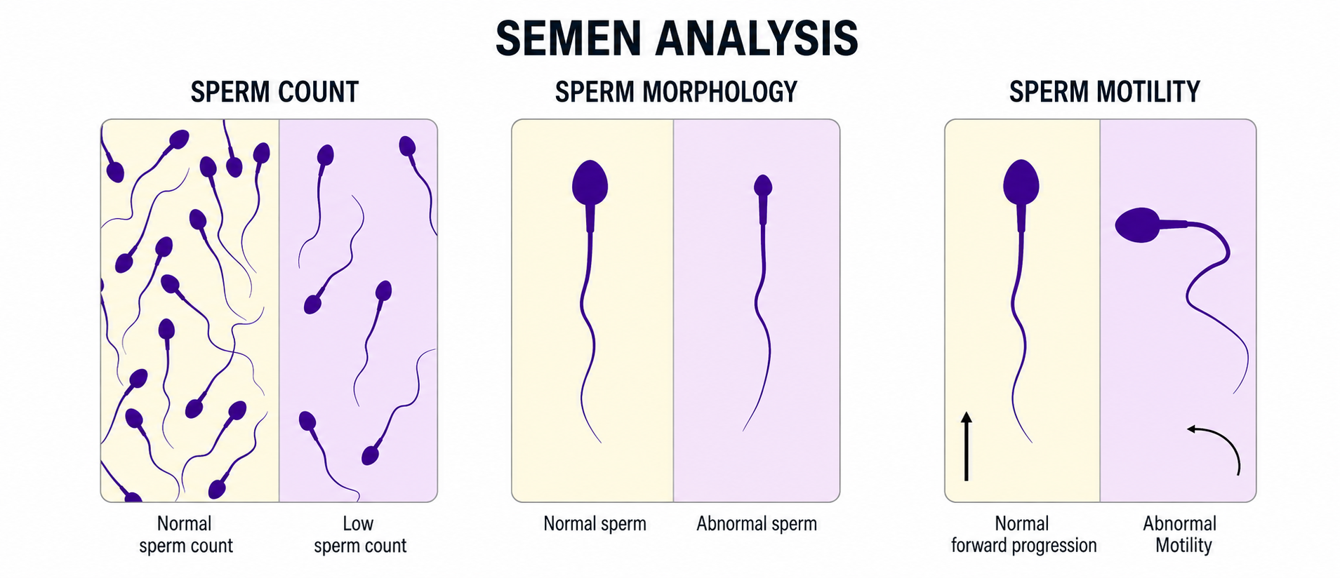 l-carnitine sperm morphology What is a Normal Count? Size:6cc bottle (dropper top) 10x NatureGift Coffee 21 cdr