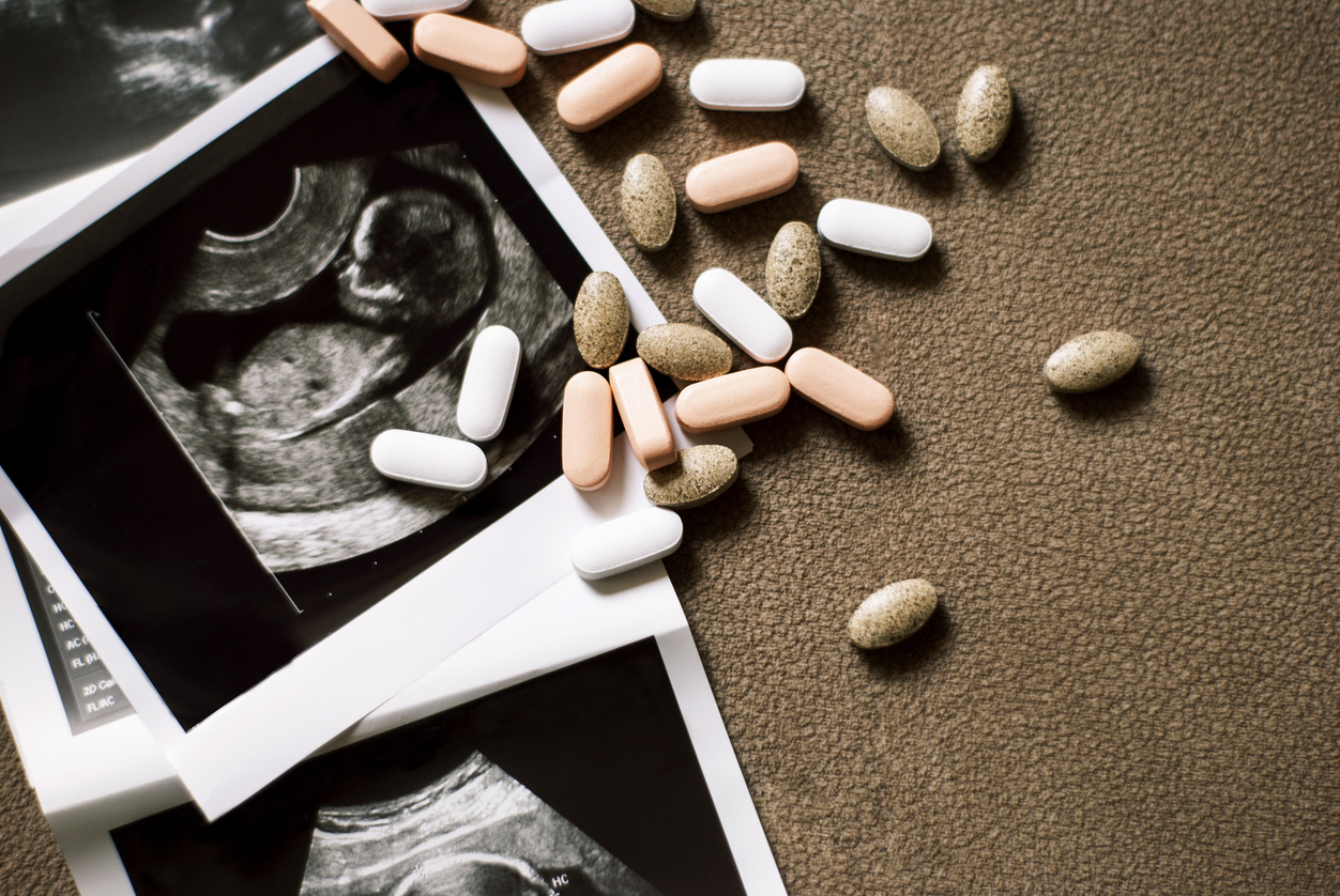 An ultrasound scan sits on a table surrounded by a variety of prenatal vitamins.